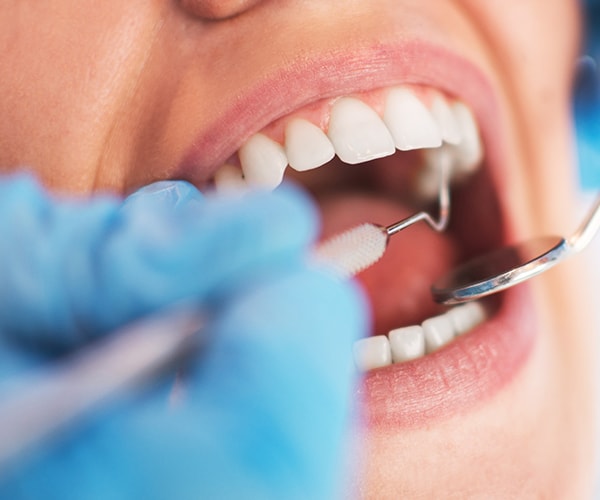 研究中的质地分析:牙科
